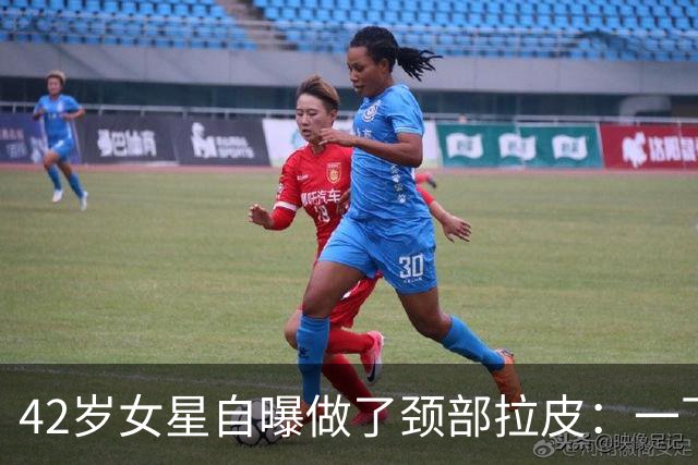 42岁女星自曝做了颈部拉皮：一下年轻20岁，但选医生要小心